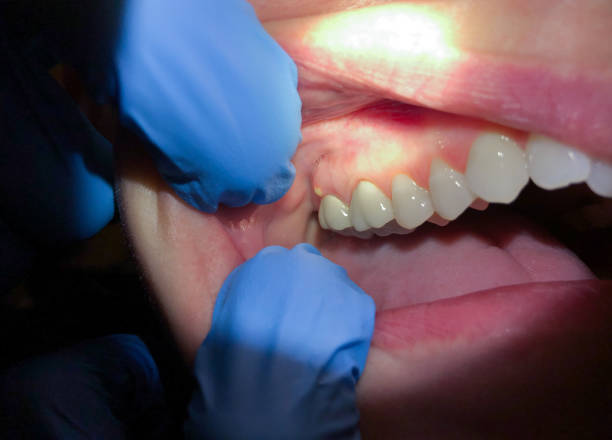 Best Emergency Dentist for Knocked-Out Tooth in Floral Park, NY